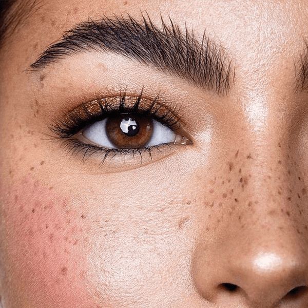 Browlift Nancy rehaussement sourcils